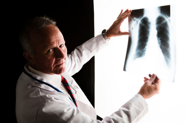 पल्मोनरी इम्बोलिज्म (Pulmonary Embolism)