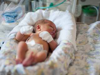 Hirschsprung Disease – Symptoms, Causes, Treatment, Preventions, Diagnosis