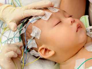 What is the Prognosis of Infantile Neuroaxonal Dystrophy?