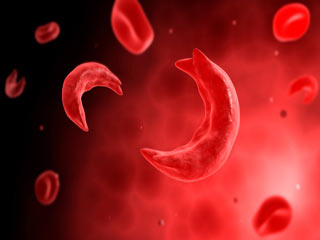 Von Willebrand Disease: How common is it?