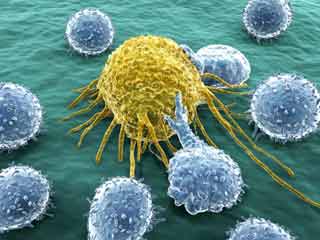 What are the symptoms of Anal Cancer?