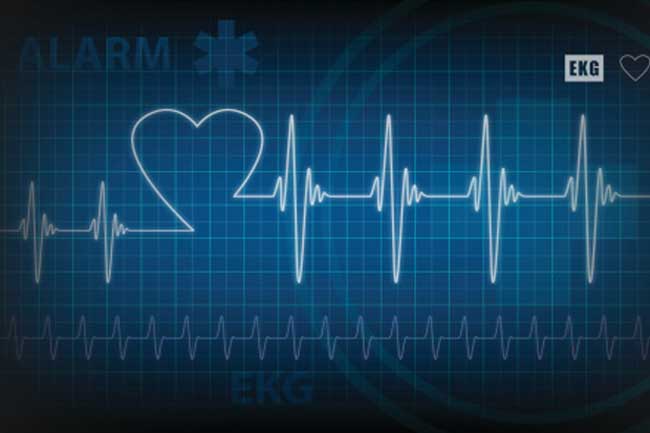 Spasm of a Coronary Artery