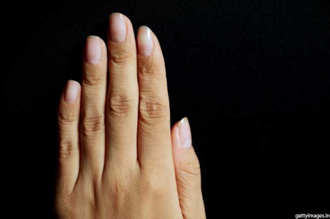 नाखूनों की समस्या