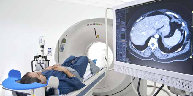 The Four Stages of Brain Cancer