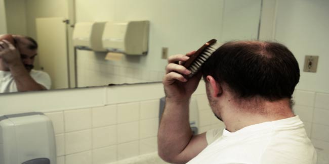 Hopes to Cure Baldness