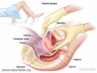Cervical cancer and its Treatment 