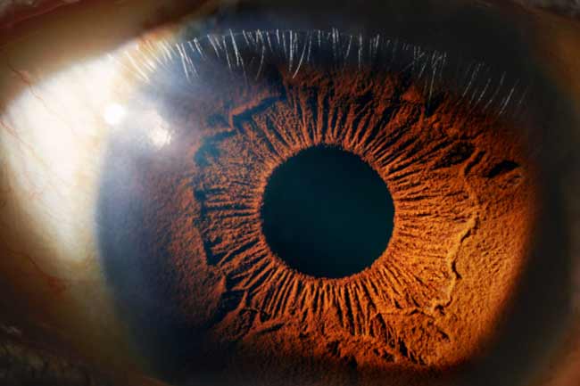 Sclera