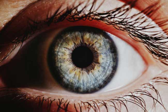 Iris