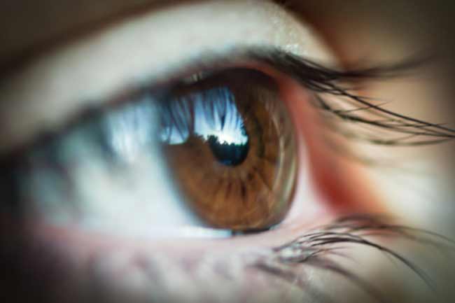 eye pupil disorder