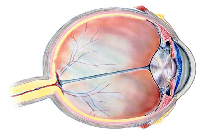 Vitreous Gel