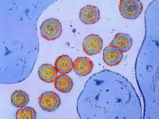 Diet affects the Gut Microbes Differently in Men and Women