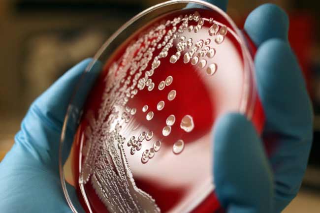 Inhibits growth of Bacteria