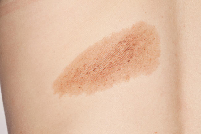 Skin Cancer