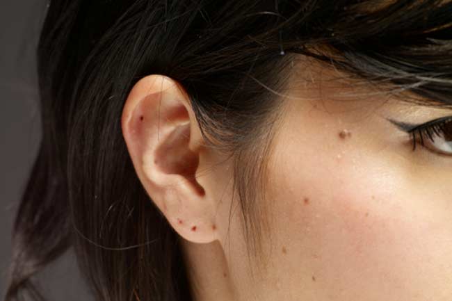Monitor the Moles