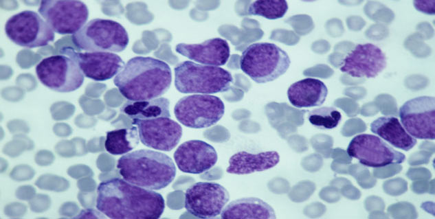 What is the prognosis of Central Nervous Embryonal Tumour?