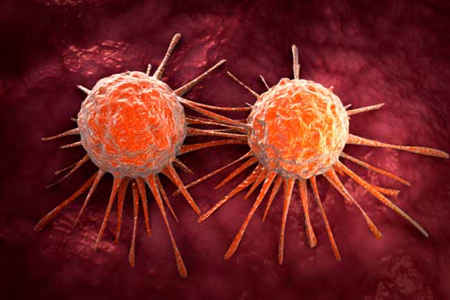 Pancreatic Cancer