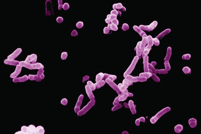 Tuberculosis (TB)