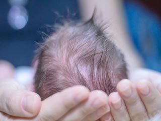 What is the treatment of Sotos Syndrome?