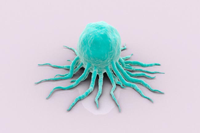 Causes of Cancer