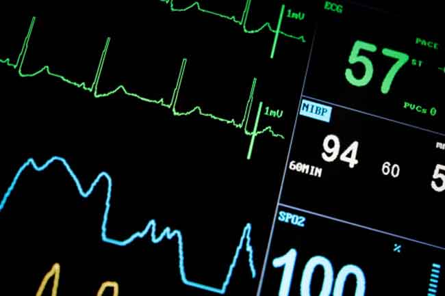 how to diagnose afib with rvr