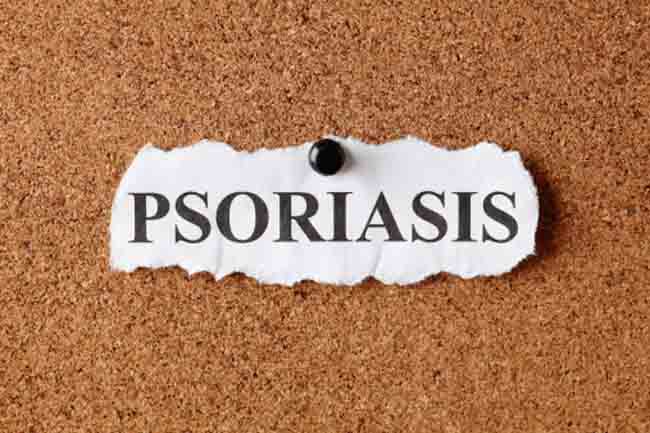 Psoriasis