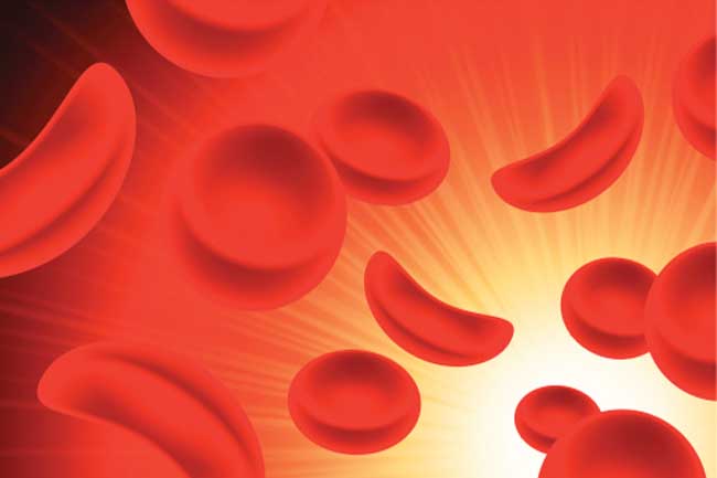 Anaemia