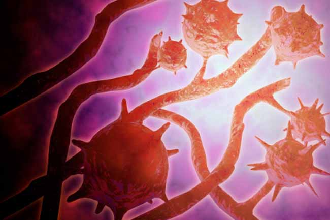 Frequent Infections