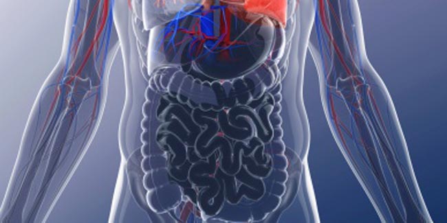 What is Bowel Obstruction?