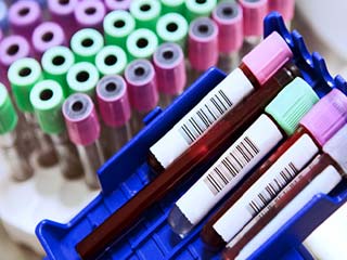 10 Things Your Doctor Won&rsquo;t Tell You About Blood Tests