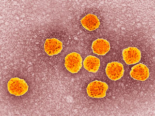 Hepatitis C increases Risk of Cancer