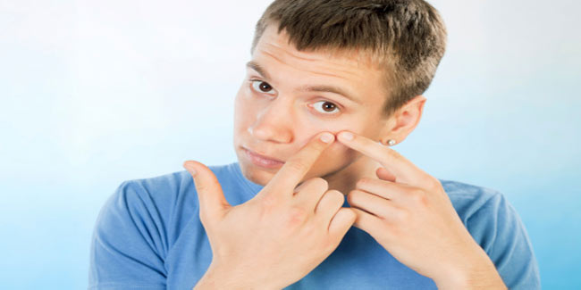 Pimple Care Tips for Men