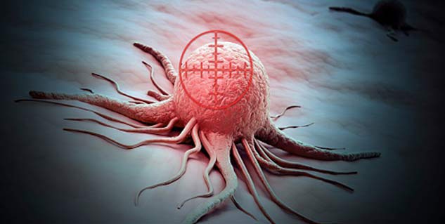 पैंक्रियाटिक कैंसर Pancreatic Cancer in Hindi