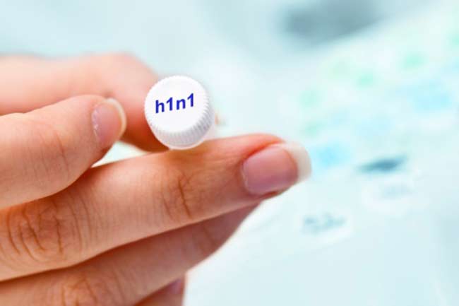 H1N1 flu