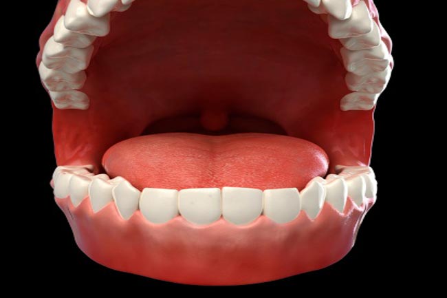 मसूड़ों की समस्या