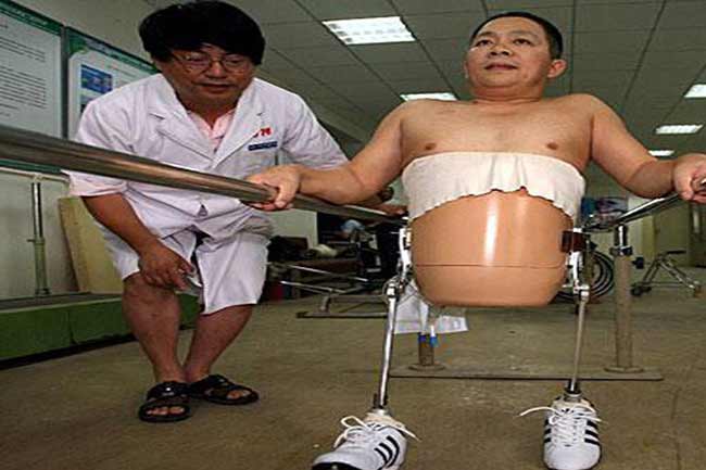 नीचे के शरीर के बिना चल-फिर रहे