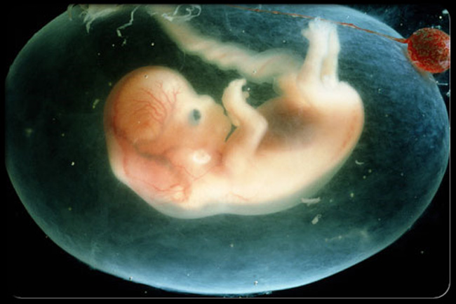 inside womb babies activity