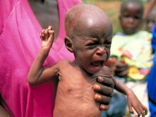 Malnutrition reducing faster than expected in India