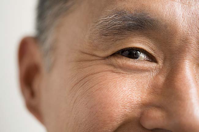 Delay The Onset of Wrinkles