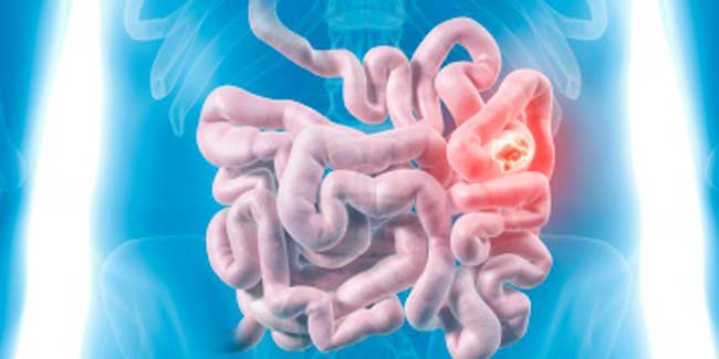 What is Small Intestine Cancer?