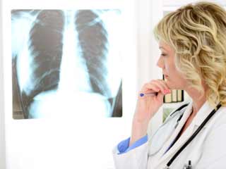 Risk Factors for Chronic Obstructive Pulmonary Disease (COPD)