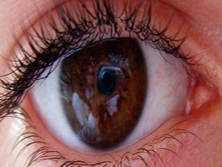 Eye Tracking Technology Can Detect Concussions