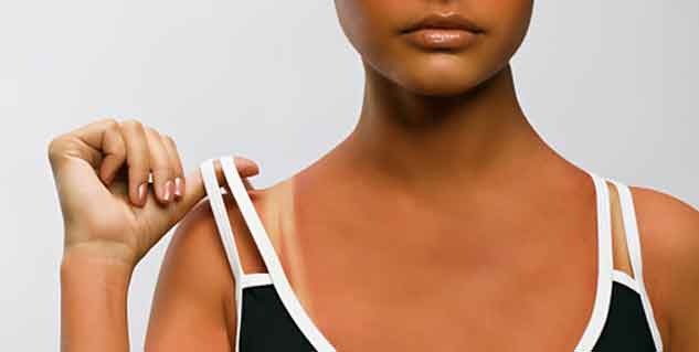 Difference between Sunburn and Sun Tan | Understand Sun-Damaged Skin