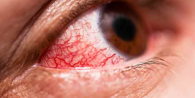 eye-flu-treatment-by-expert-other-diseases