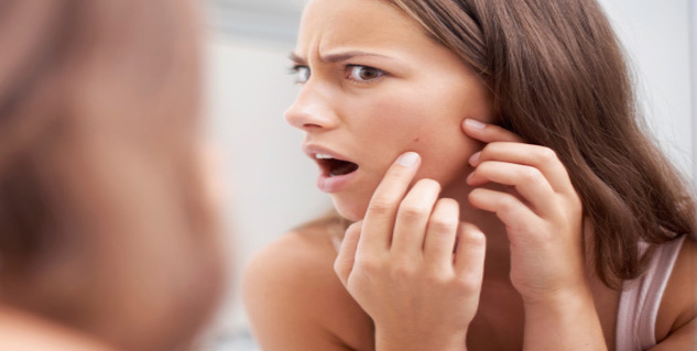 मुंहासे  pimples in Hindi