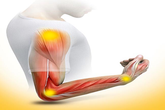 गिलेन बेर सिंड्रोम (Guillain-Barré Syndrome)