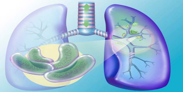 tuberculosis-causes-unintentional-and-unexplained-weight-loss-weight