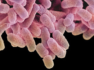 Controlling typhoid is key to preventing bladder cancer
