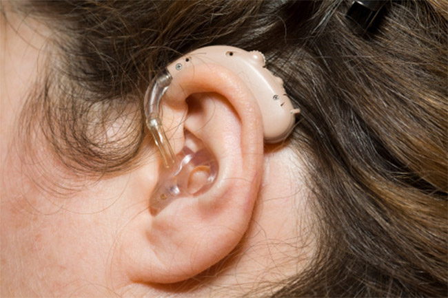 Hearing aids repair hearing to normal