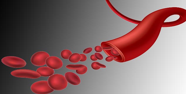 What Is Haemophilia B - Get Information On Haemophilia B | Blood Diseases