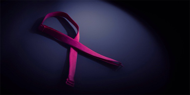 Molecular marker identified to predict breast carcinoma